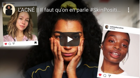 Vidéo Youtube du 02/02/2020 de A.I.M (@aimyt_ sur Instagram) autour de la #SkinPositivity