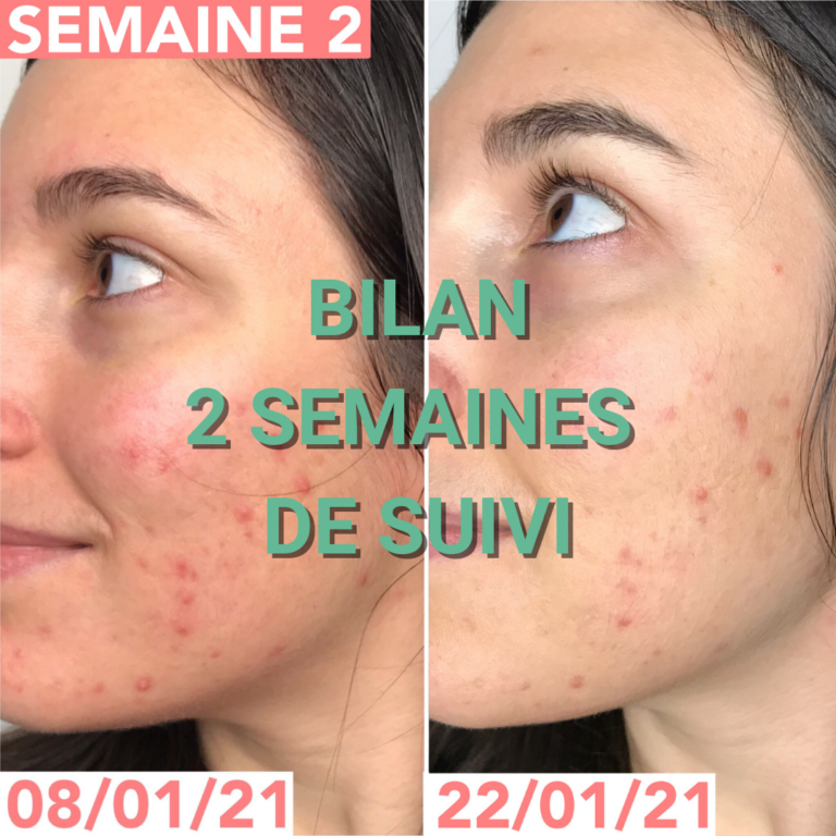 Journal de bord semaine 2 : sans sucre, alcool, gluten, produits laitiers et chocolat