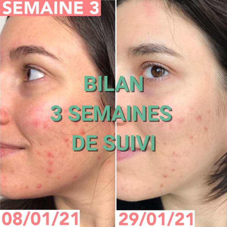 Journal de bord semaine 3 : sans sucre, alcool, gluten, produits laitiers et chocolat