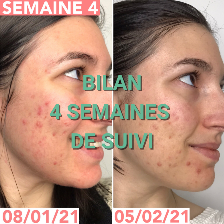 Journal de bord semaine 4 : sans sucre, alcool, gluten, produits laitiers et chocolat