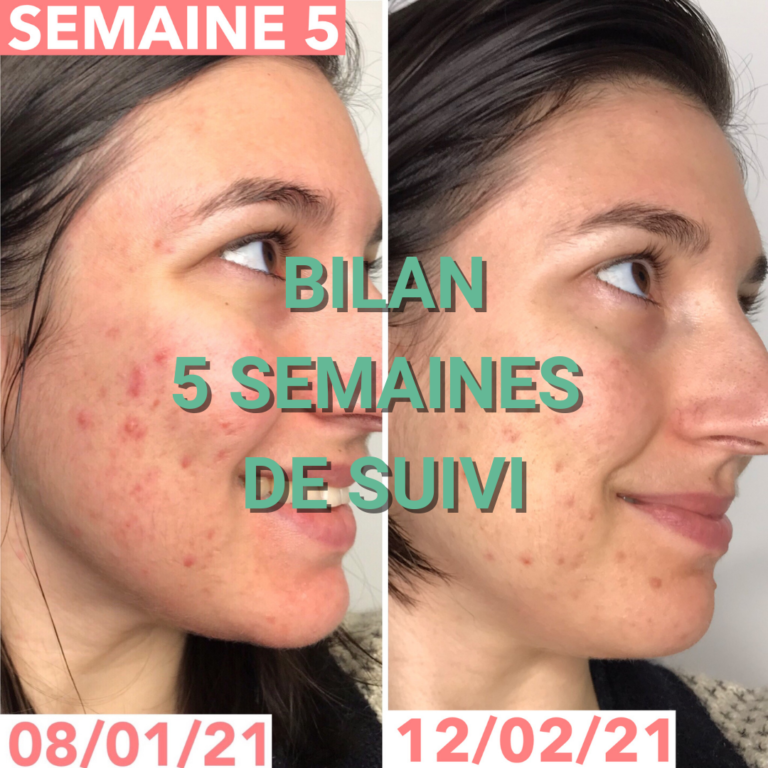 Journal de bord semaine 5 : sans sucre, alcool, gluten, produits laitiers et chocolat