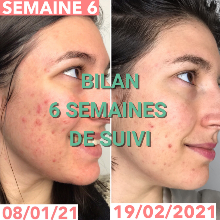Journal de bord semaine 6 : sans sucre, alcool, gluten, produits laitiers et chocolat