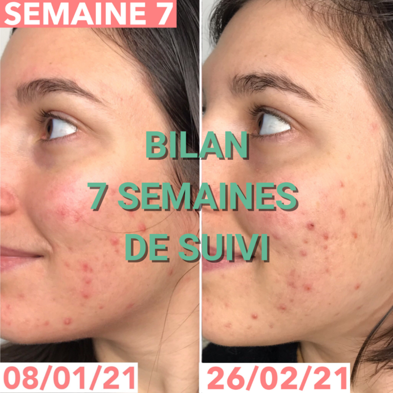 Journal de bord semaine 7 : sans sucre, alcool, gluten, produits laitiers et chocolat