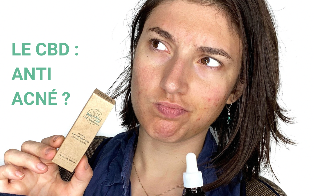 Le CBD : efficace contre l’acné ?