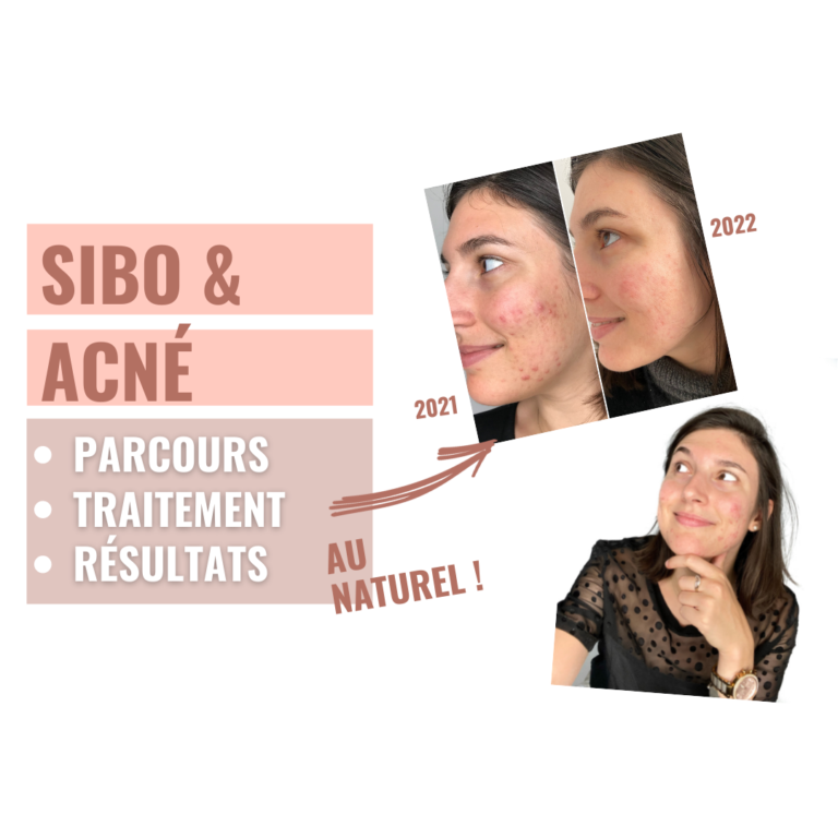SIBO et ACNÉ : MON PARCOURS CHAOTIQUE ET MA PREMIÈRE VICTOIRE