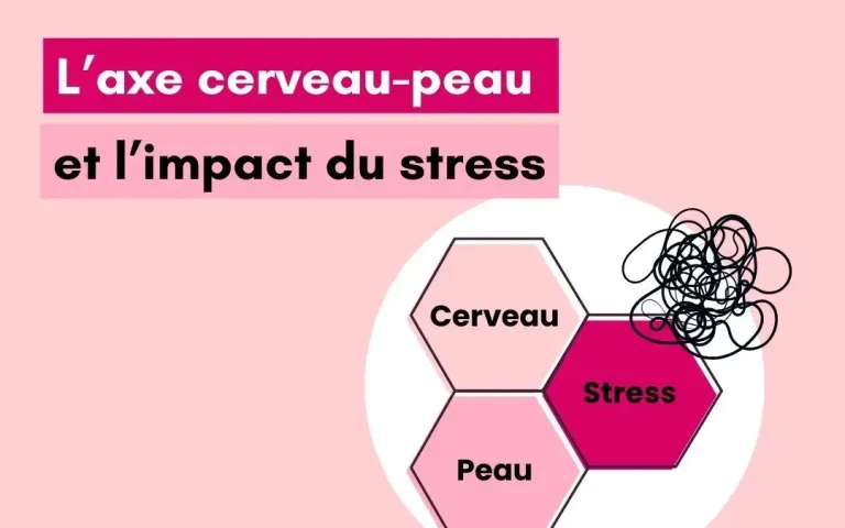 Le lien profond entre le stress et l&rsquo;acné