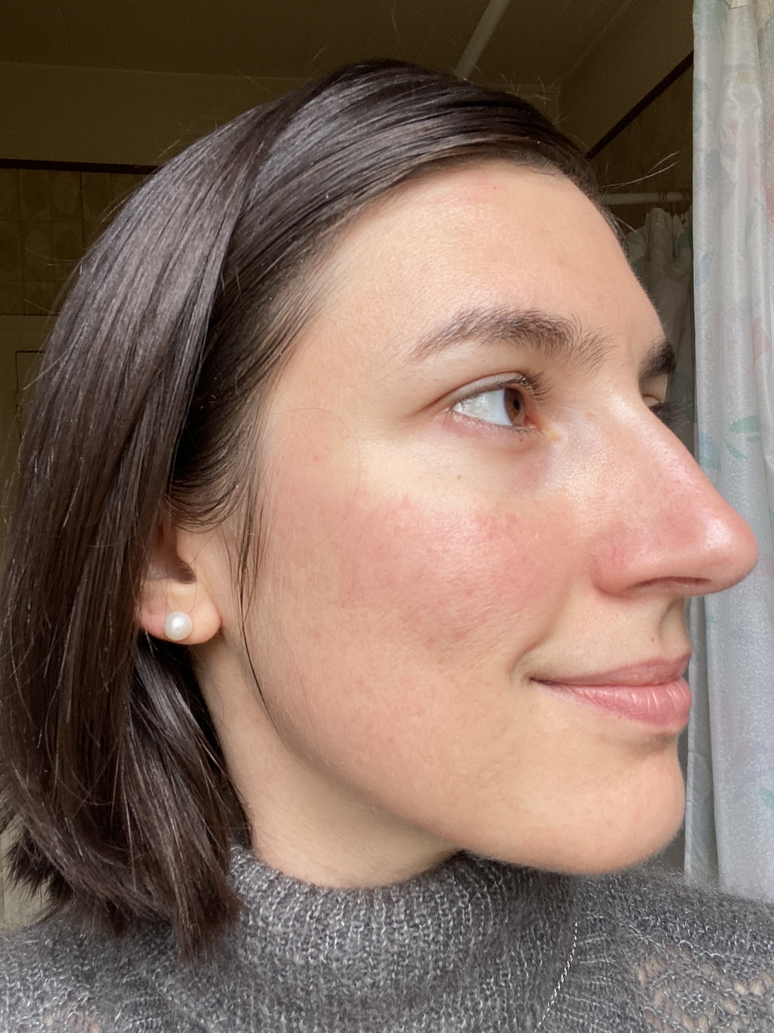 Anne après, peau apaisée